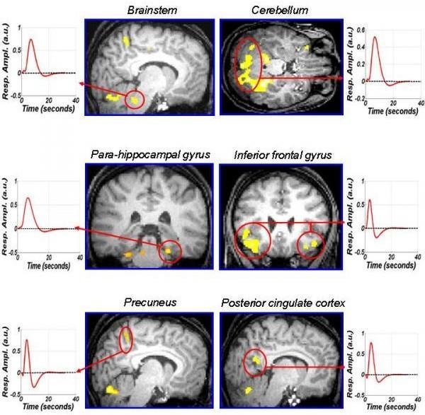 brain research